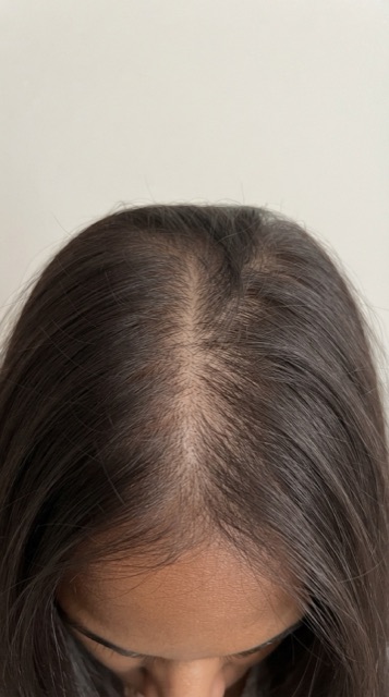 Hair, April 12